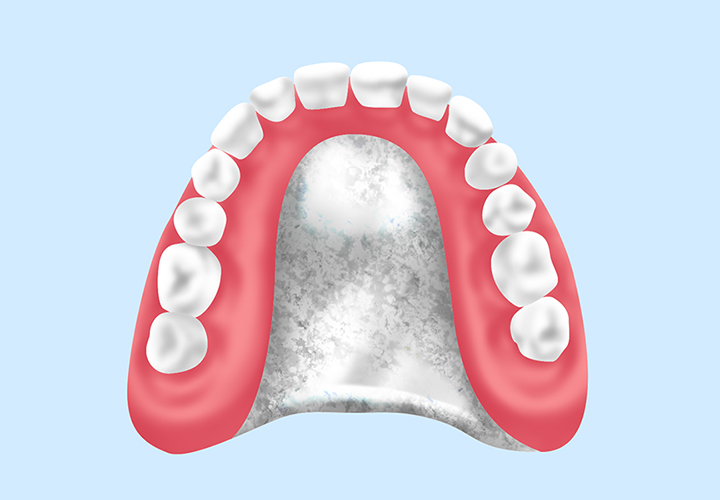 保険診療の入れ歯