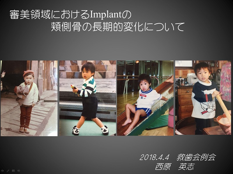 救歯会例会発表