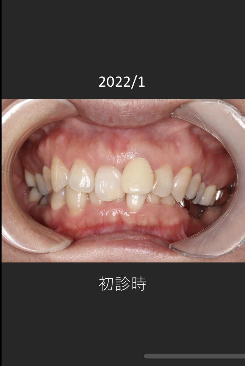 治療前