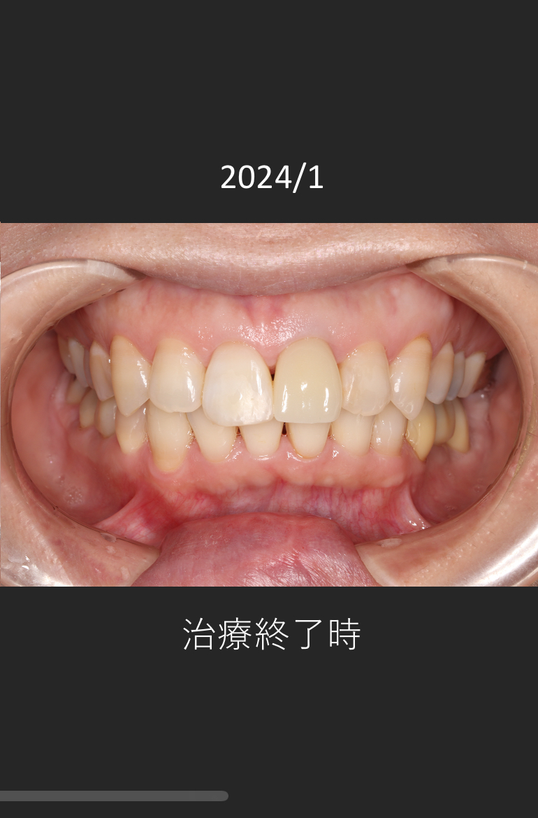 治療後